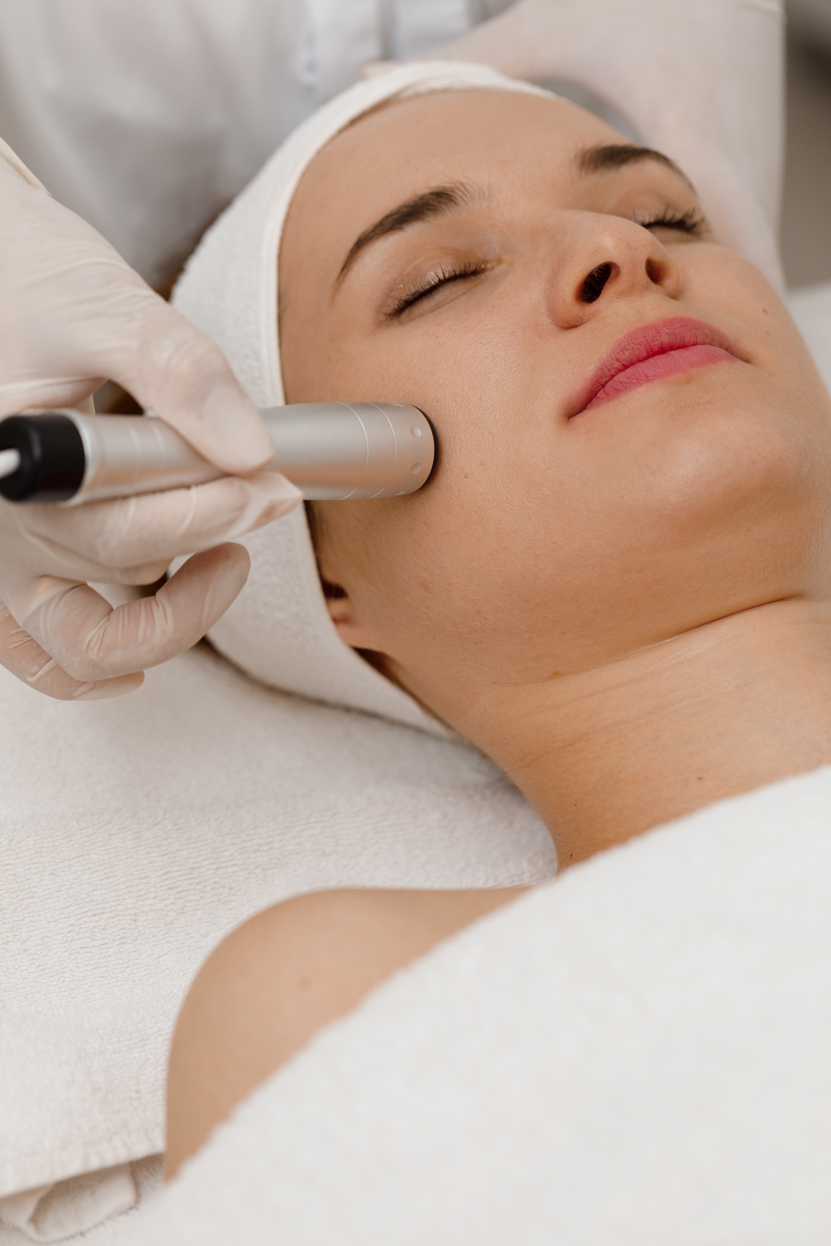 RF Lifting- Radiofrecvență