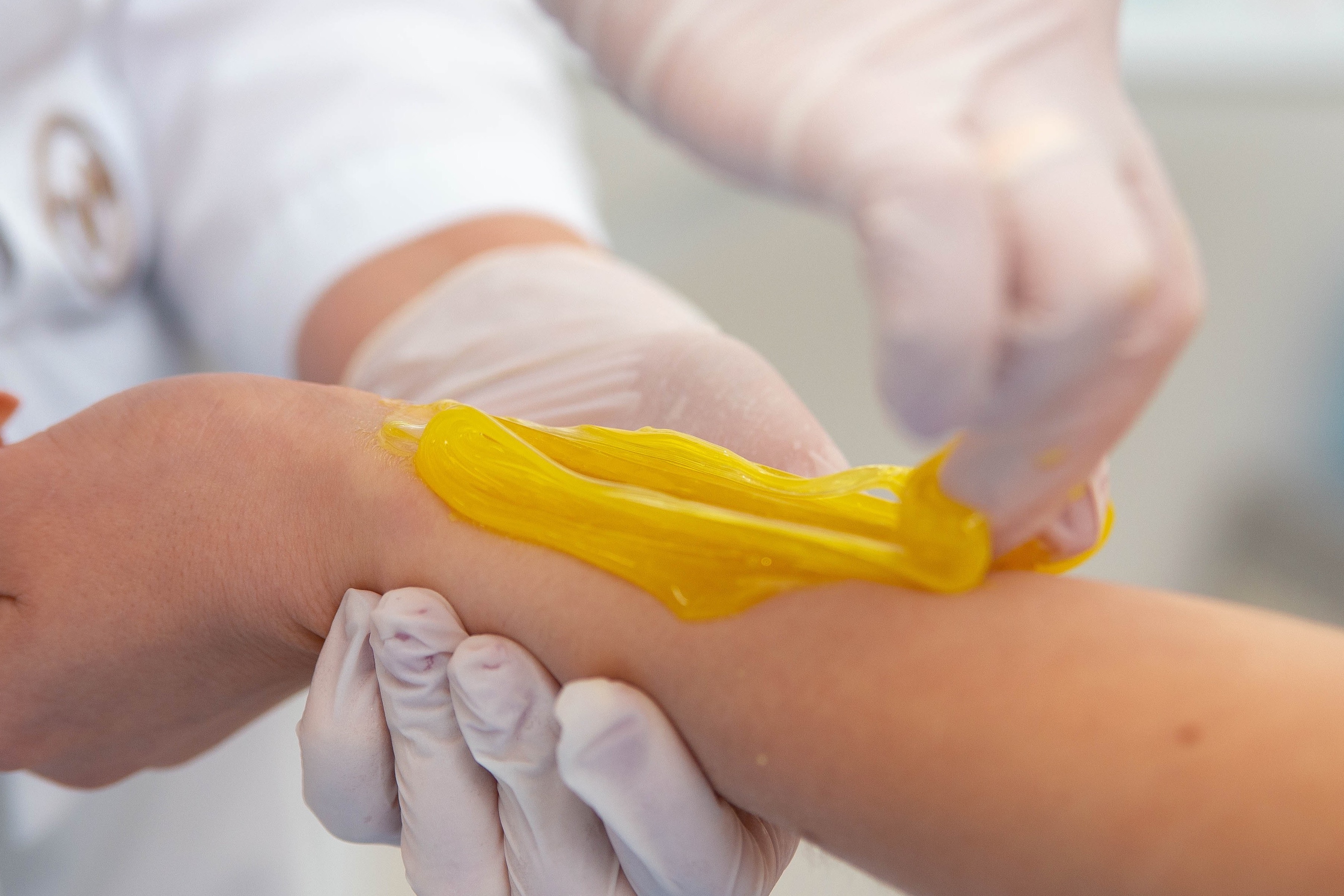 Epilare cu ceara/ zahăr