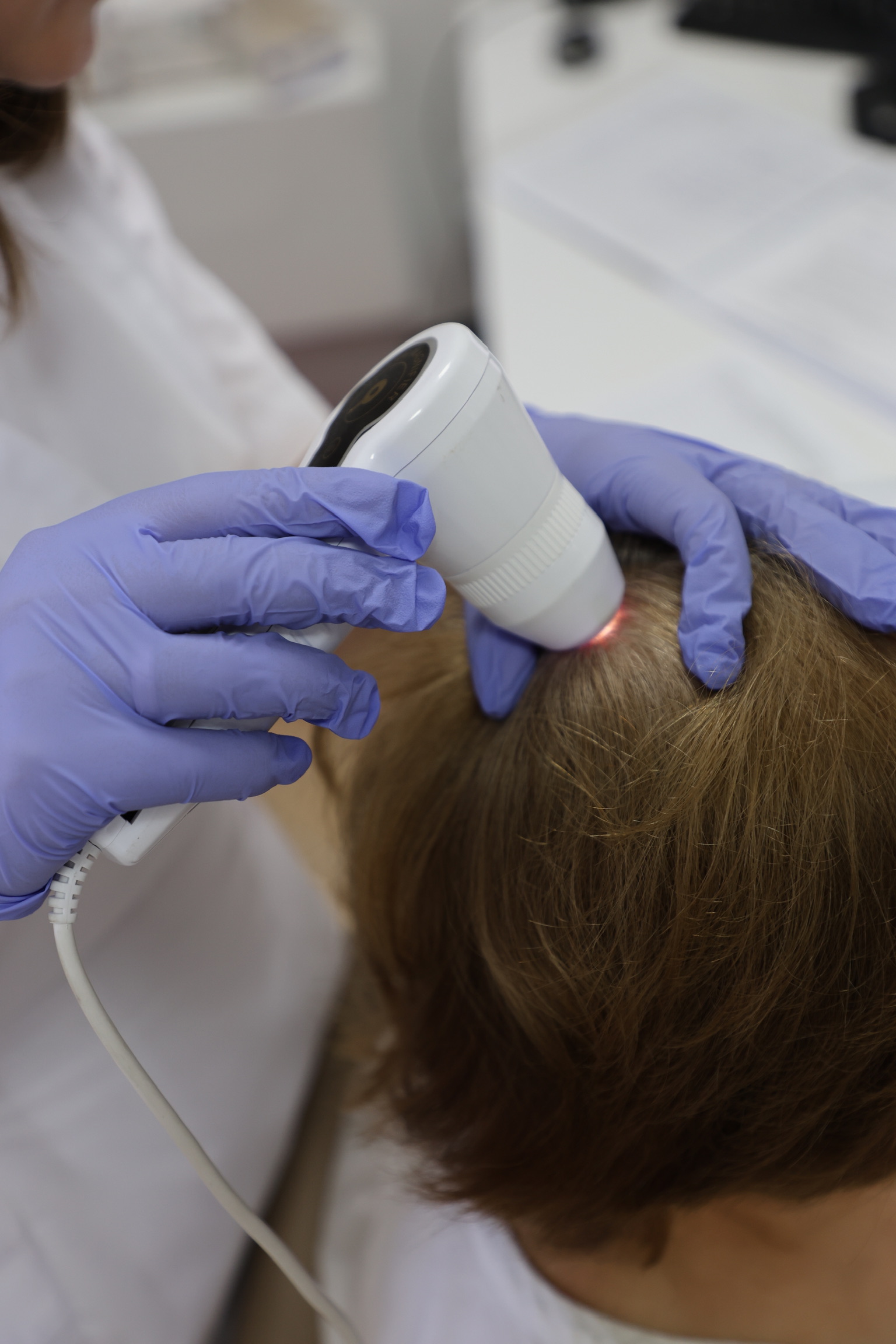 Consultație triholog / Trihoscopie scalp